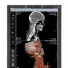 NEC Display Solutions / MD210C2 : spécial métiers médicaux